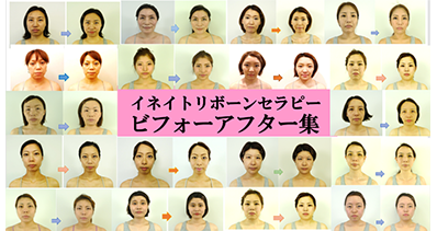 MBI美容整体スクール　ビフォーアフター集